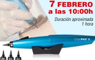 crioterapia con cryopen