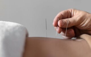 terapia con agujas