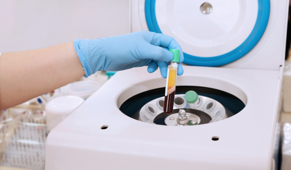 prp-rich-plasma-en-belexpress